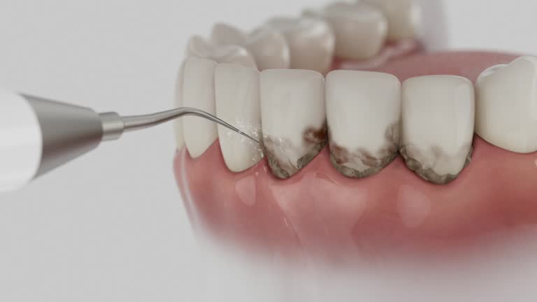 Reliable Dental Implants contractor in New Beaver, PA by Smile Center Dentistry